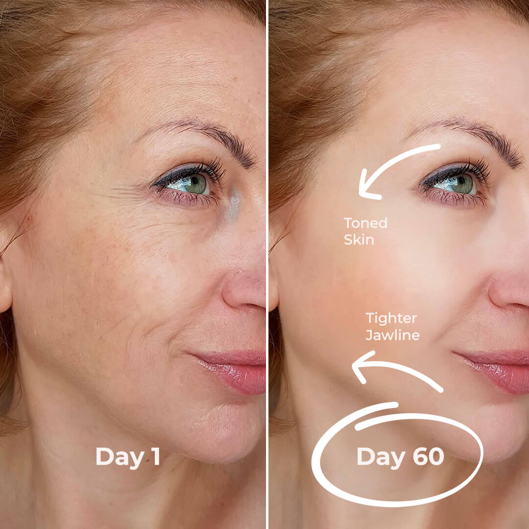 5MinSkin MikroSculpt + Hyaluronsäure Serum (30 Tage Vorrat)