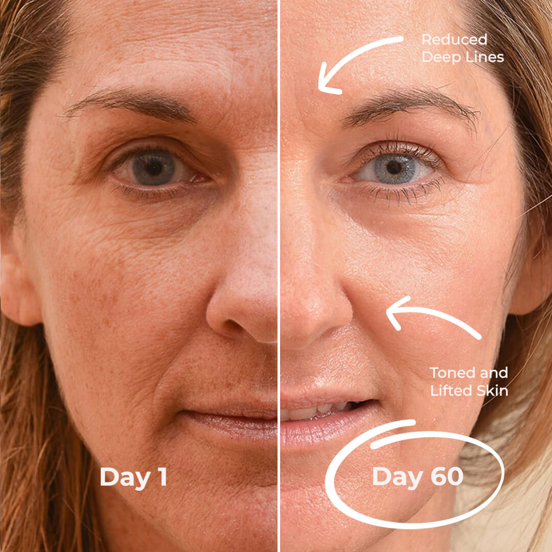 5MinSkin MikroSculpt + Hyaluronsäure Serum (30 Tage Vorrat)