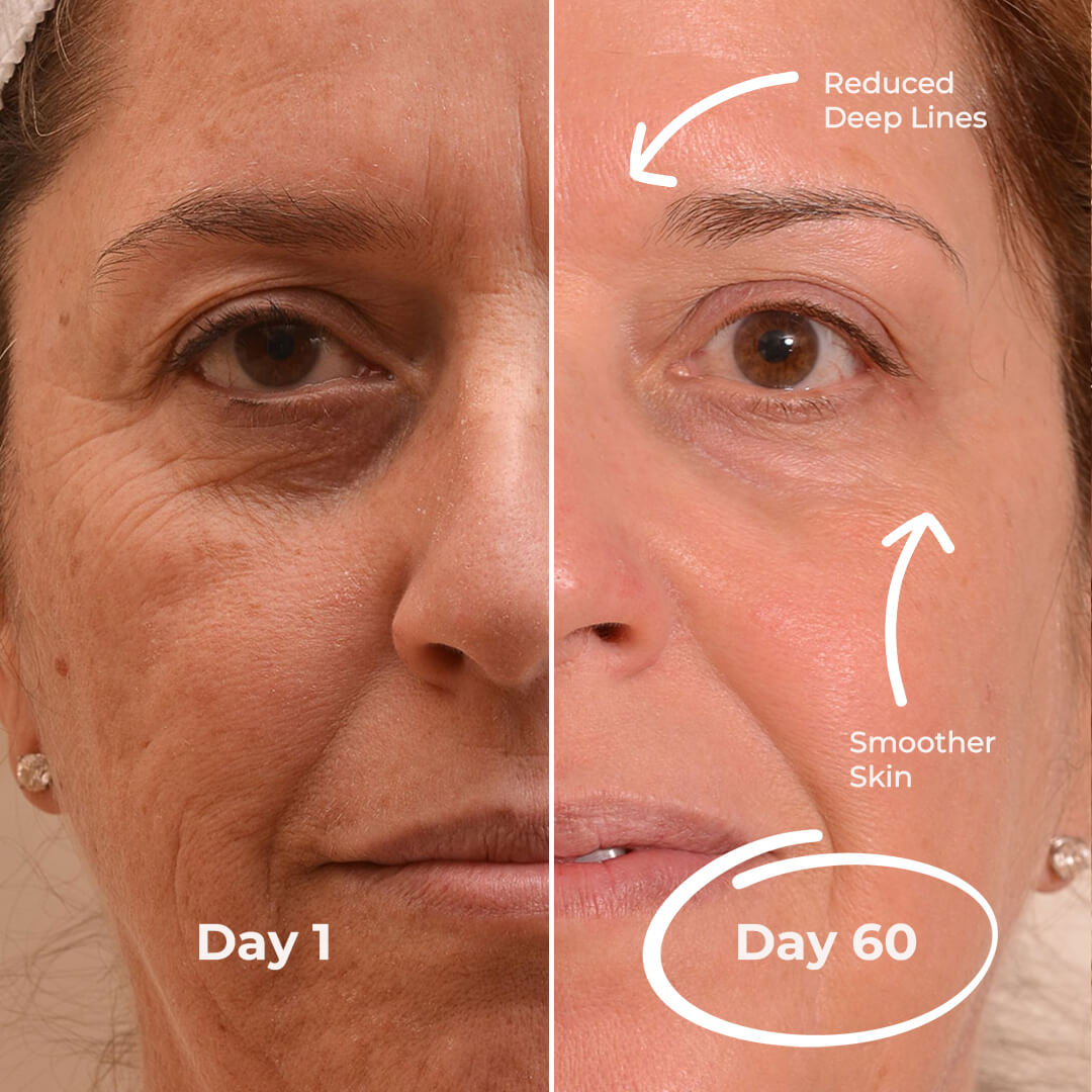 5MinSkin MicroSculpt + Hyaluronzuur Serum (30 Dagen Voorraad)